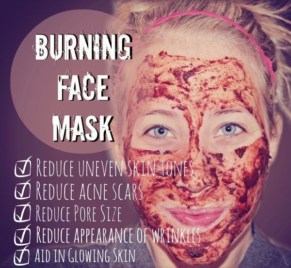 acne face mask, acne marks, acne spots, hormonal acne, diy face mask, clear skin face mask, glowing skin face mask, face mask for uneven skin tone, fade acne scars fast, face mask for smooth skin, face mask for open pores, honey face mask, cinnamon face mask, nutmeg face mask, lemon face mask, beauty face mask, beauty treatments at home, natural face mask, organic face mask, miracle face mask, burning face mask, face mask to cure acne, face mask for acne marks, face mask for acne spots, organic face mask, safe face mask, detoxifying face mask, smoothening face mask, anti aging face mask, moisturizing face mask, face mask that works on pumpernickel pixie
